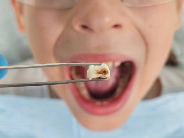 Best Same-Day Emergency Dentist in Pleasant Garden, NC